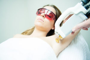 Removing Underarm Hair With A Laser